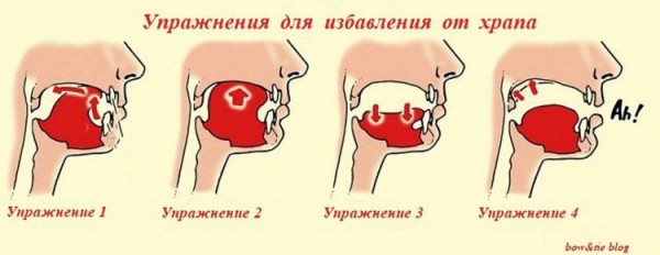 Как избавиться от храпа